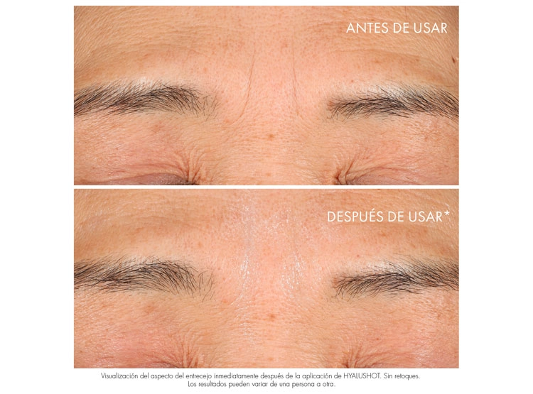 SERUM FACIAL DIOR ANTIARRUGAS CORRECTOR CAPTURE TOTALE HYALUSHOT 15 ML - 2