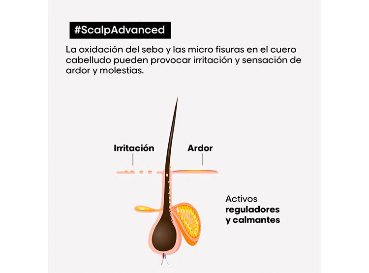 SHAMPOO L'ORÉAL PROFESSIONNEL NIACINAMIDA ANTIIRRITACIÓN CUERO CABELLUDO IRRITADO 300 ML - 6