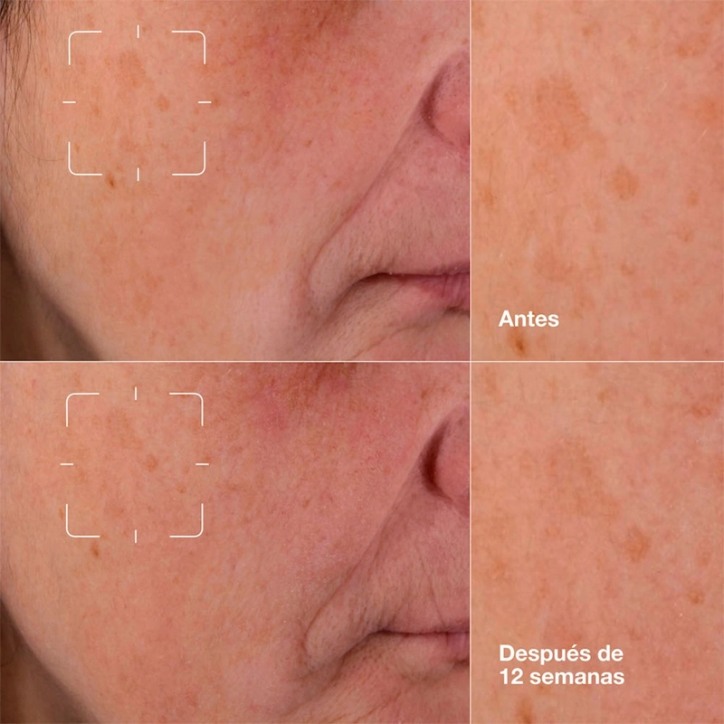 SÉRUM CLINIQUE 50 ML EVEN BETTER CLINICAL DARK SPOT CLEARING - 6