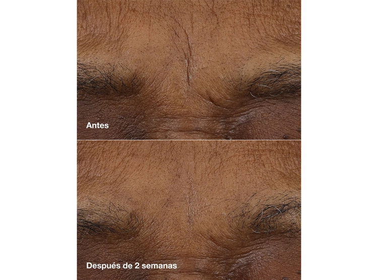 BÁLSAMO CLINIQUE RETINOID BALM SMART CLINICAL REPAIR - 3
