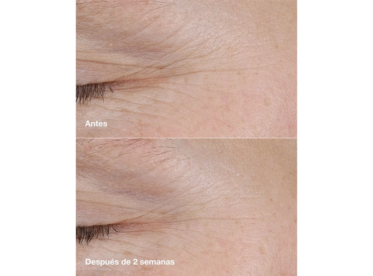 BÁLSAMO CLINIQUE RETINOID BALM SMART CLINICAL REPAIR - 4