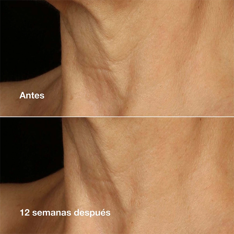 CREMA ANTIEDAD CLINIQUE SMART FACE + NECK 75 ML - 5