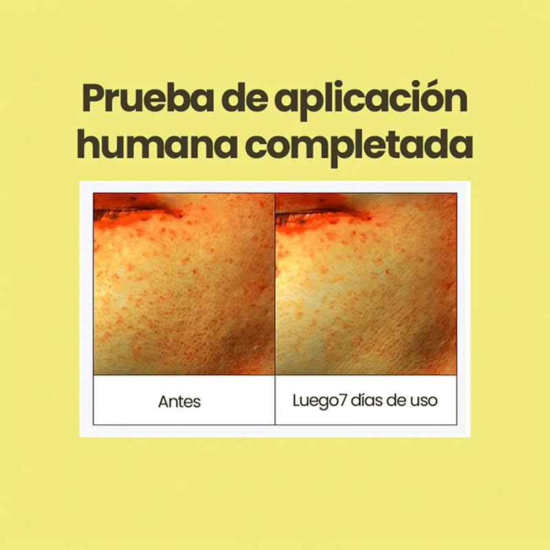 SÉRUM AMPLEN DESPIGMENTANTE 50 ML - 7