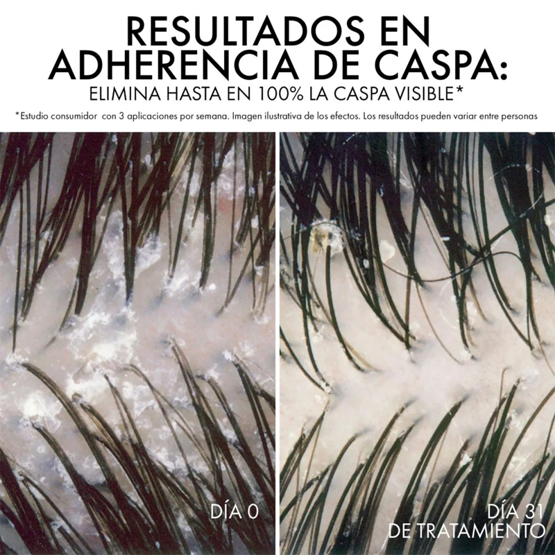 SHAMPOO ANTICASPA VICHY DERCOS ECO REFILL 390 ML - 3