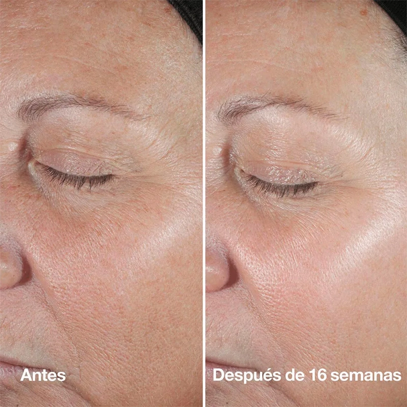 SUERO ANTIEDAD CLINIQUE SMART CLINICAL REPAIR 5ML - 11