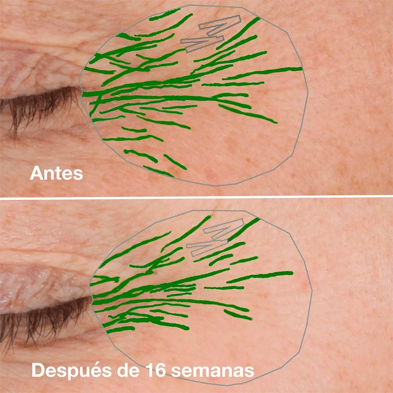 SUERO ANTIEDAD CLINIQUE SMART CLINICAL REPAIR 5ML - 12
