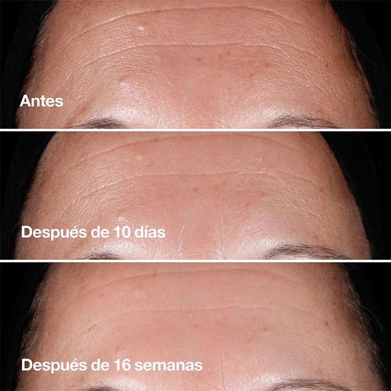 SUERO ANTIEDAD CLINIQUE SMART CLINICAL REPAIR 5ML - 10