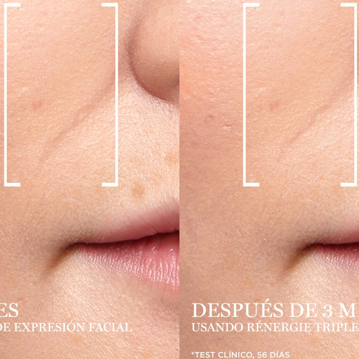 SET TRATAMIENTO ANTIEDAD LANCOME RÉNERGIE H.C.F TRIPLE SERUM 50 ML + 5 ML + 15 ML + 15 ML - 4