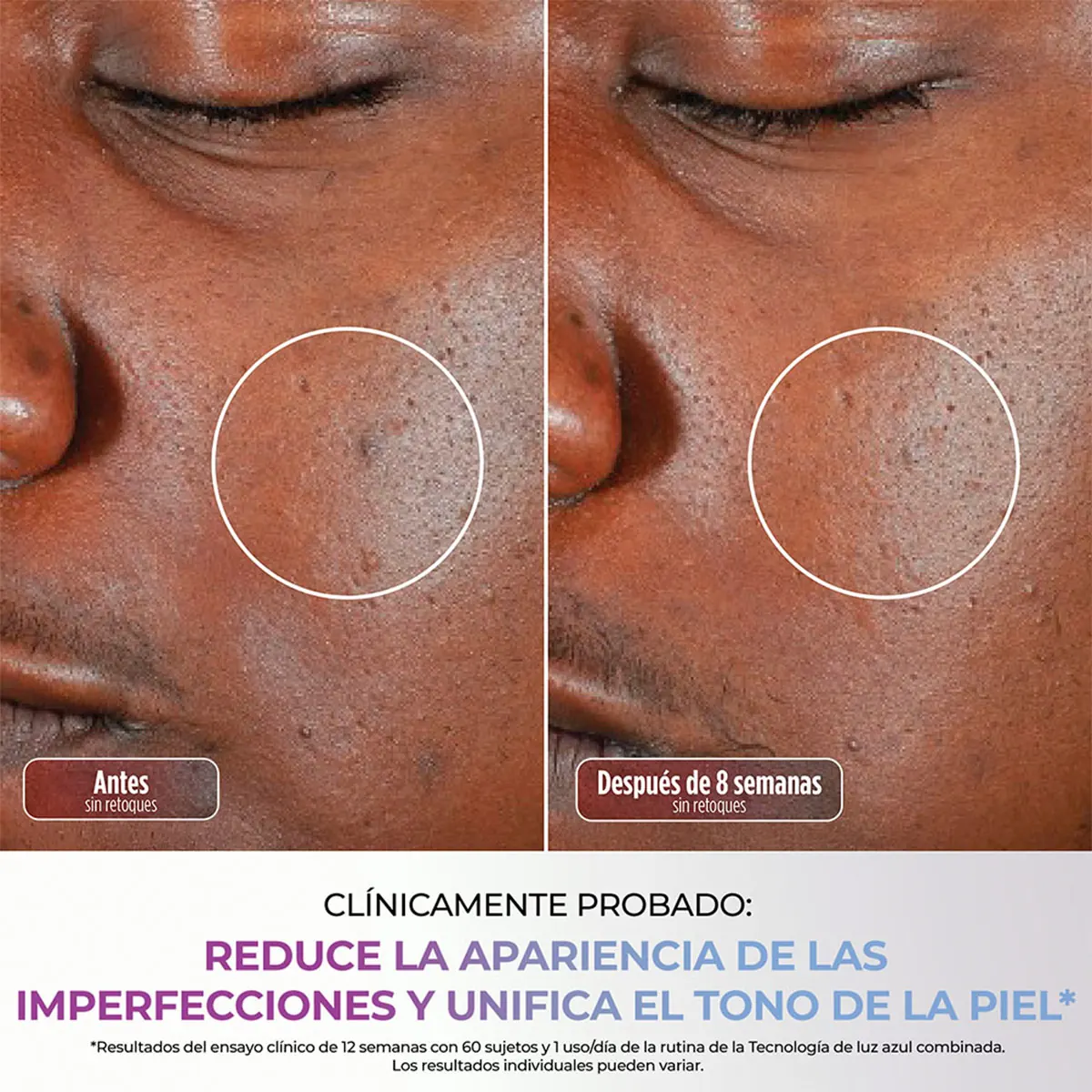 MÁSCARA FACIAL LED SHARK CRYOGLOW FW312LAA - 11
