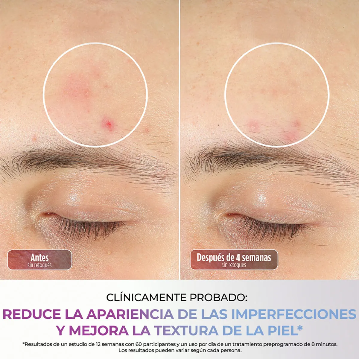 MÁSCARA FACIAL LED SHARK CRYOGLOW FW312LAA - 12