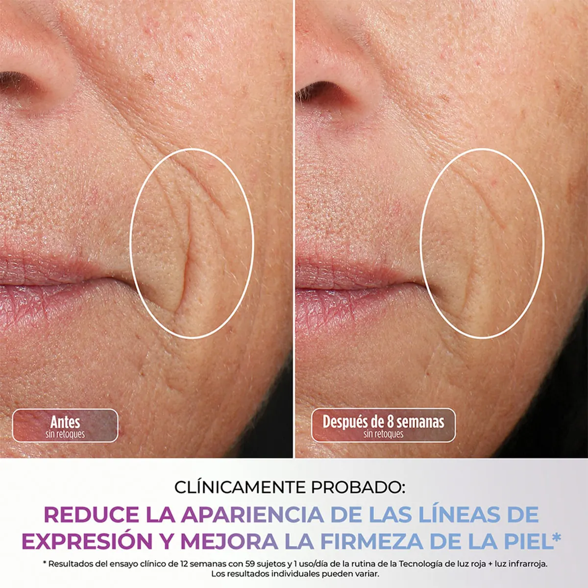MÁSCARA FACIAL LED SHARK CRYOGLOW FW312LAA - 10
